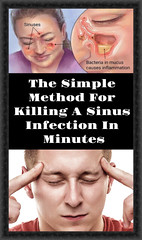 The Simple Method For Killing A Sinus Infection In Minutes